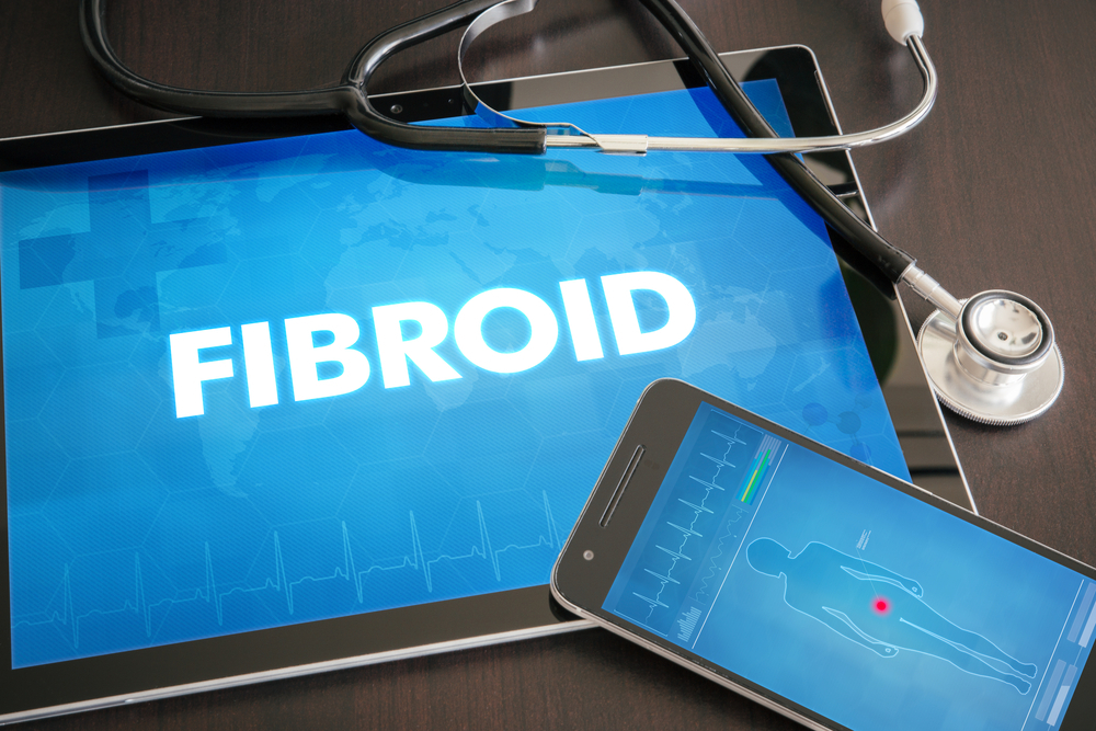 Do Fibroids Cause Infertility And Affect Your Pregnancy?